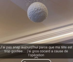 Dita Istrefi (Les Princes et les Princesses de l'amour 3) agressée et défigurée : elle se montre en photos et en stories vidéos après l'opération au visage