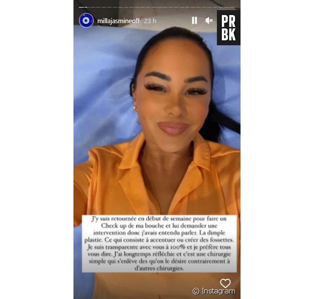 Milla Jasmine dévoile sa nouvelle opération de chirurgie esthétique au visage : des fossettes aux joues !