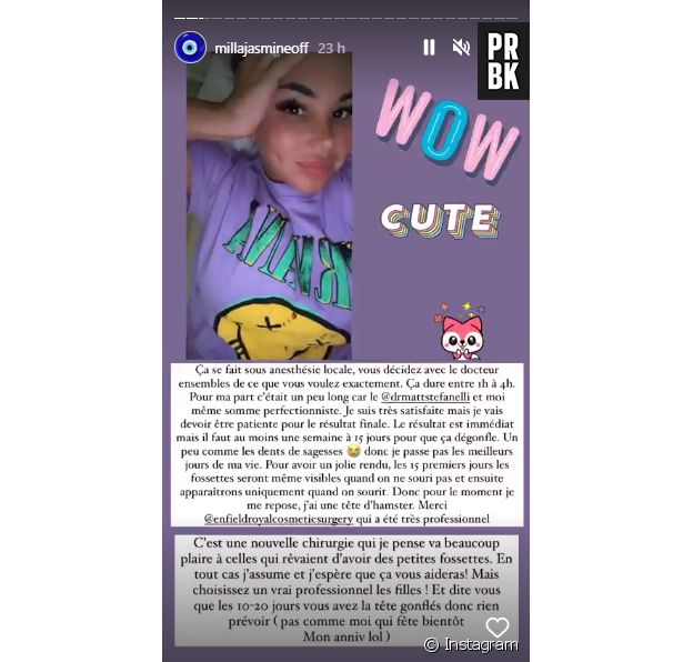 Milla Jasmine dévoile sa nouvelle opération de chirurgie esthétique au visage : des fossettes aux joues !