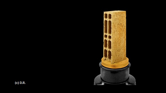 Les Gérard de la télévision 2011 : les nominations qui font mal mais qui font rire