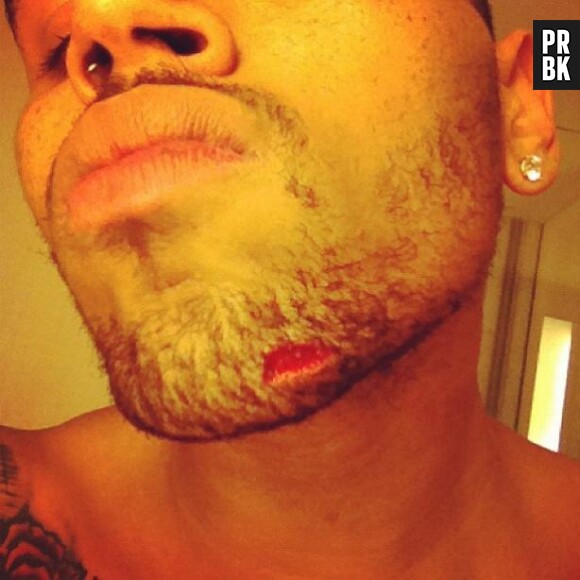 Chris Brown se faire taillader le visage par la team de Drake