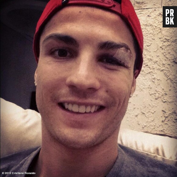 Cristiano Ronaldo : Blessé, il poste une photo sur Facebook et rassure ses fans