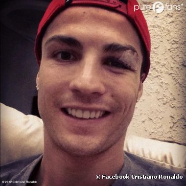 Cristiano Ronaldo : Blessé, il poste une photo sur Facebook et rassure ses fans