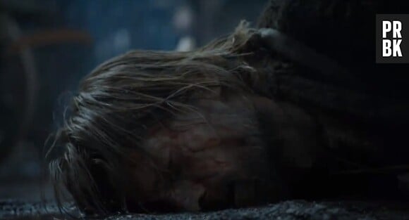Jaime toujours aussi mal en point dans Game of Thrones