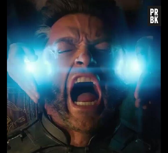 X-Men Days of Future Past : Logan va souffrir