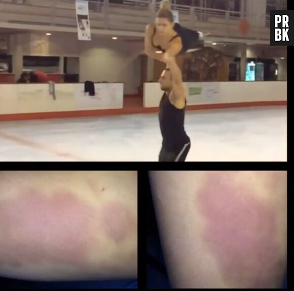 Ice Show : Clara Morgane "blessée"