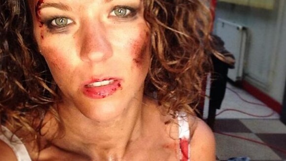 Lorie "femme battue" engagée sur Instagram pour un court-métrage