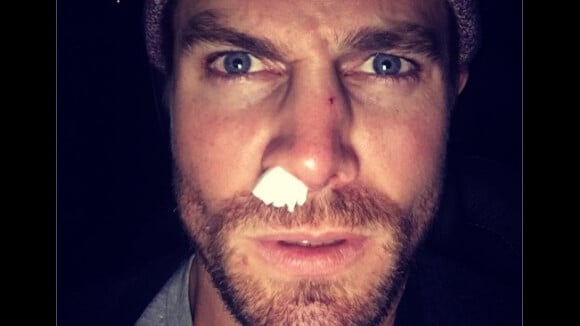 Arrow saison 5 : Stephen Amell blessé sur le tournage lors d'un combat