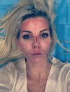 Jessica Thivenin (Les Marseillais et Les Ch'tis VS Le reste du Monde) teste le "Vampire Face Lift" et se retrouve le visage en sang.