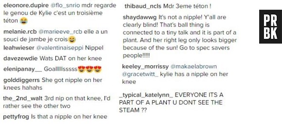 Kylie Jenner : un téton sur le genou ? La photo affole Instagram