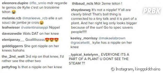 Kylie Jenner : un téton sur le genou ? La photo affole Instagram