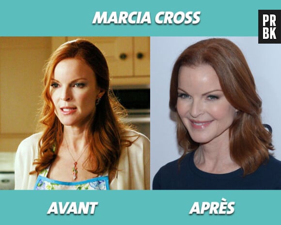 Desperate Housewives : Marcia Cross avant et après la série