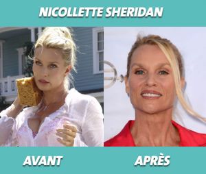 Desperate Housewives : Nicollette Sheridan avant et après la série