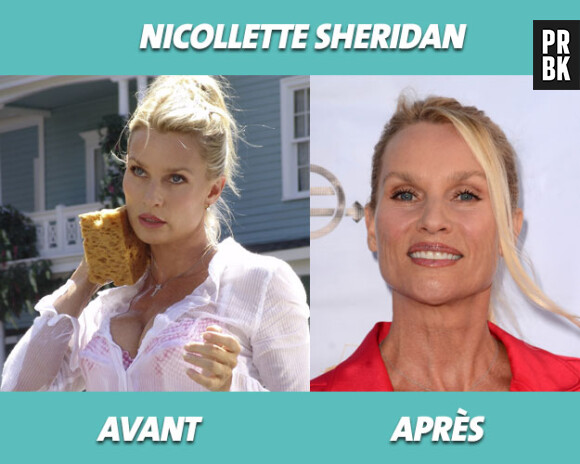 Desperate Housewives : Nicollette Sheridan avant et après la série