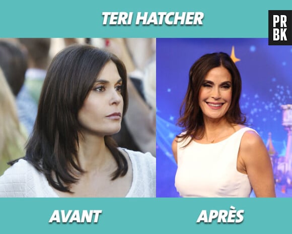 Desperate Housewives : Teri Hatcher avant et après la série