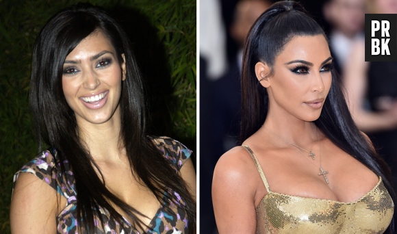Kim Kardashian : son avant/après impressionnant