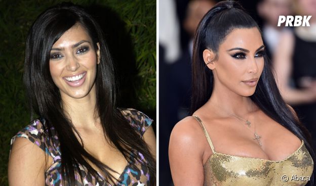 Kim Kardashian : son avant/après impressionnant