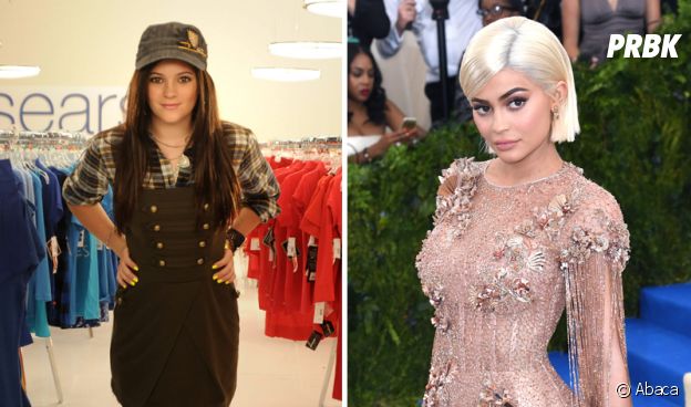 Kylie Jenner : son avant/après impressionnant