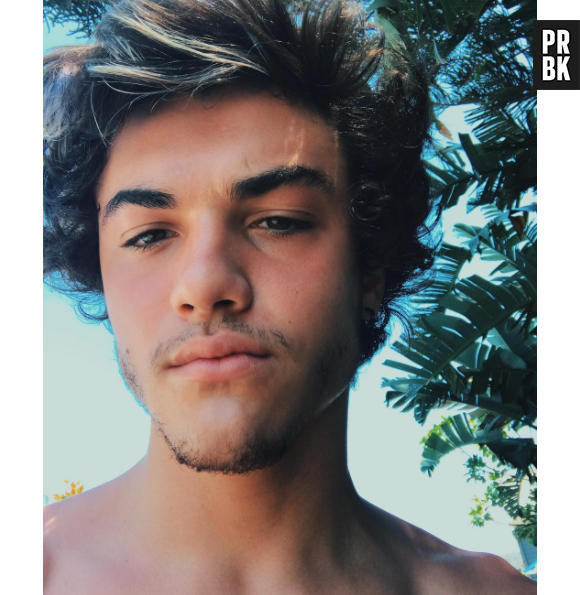Ethan Dolan hospitalisé après un accident de moto, son frère jumeau Grayson avoue avoir eu très peur