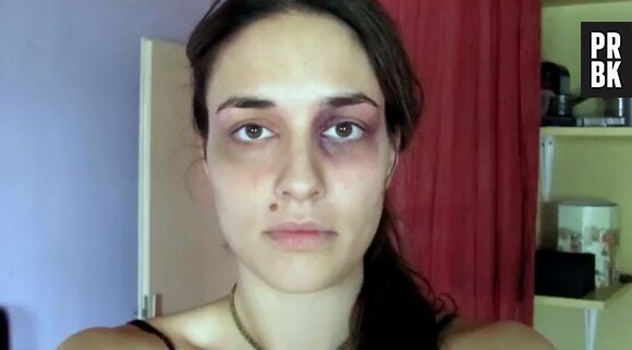 Cette Croate est l'une des nombreuses victimes de violences conjugales (vidéo postée le 18 mars 2013 sur Youtube)