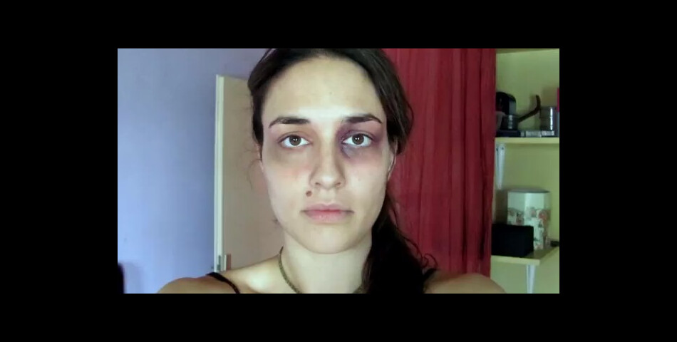 Cette Croate est l&#039;une des nombreuses victimes de violences conjugales (vidéo postée le 18 mars 2013 sur Youtube)