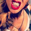 Rihanna : la chanteuse ne portait pas ses fausses dents en diamant