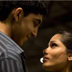 Dev Patel et Freida Pinto (Slumdog Millionaire) : que sont-ils devenus ?