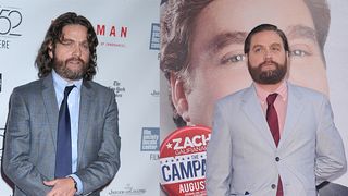 Zach Galifianakis : sa perte de poids impressionnante