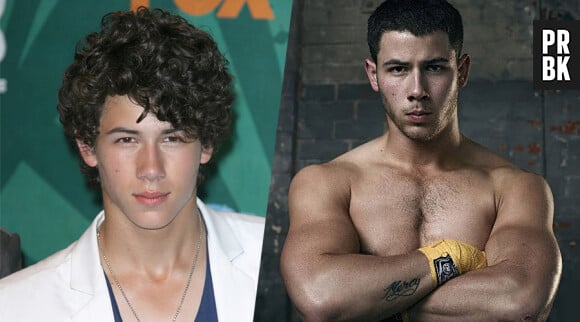 Nick Jonas : son évolution impressionante en photos