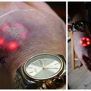 WTF : les piercings et tatouages, c&#039;est fini, place aux LED sous la peau !