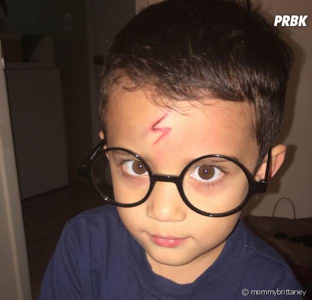 Harry Potter : une maman transforme le bobo de son fils en cicatrice