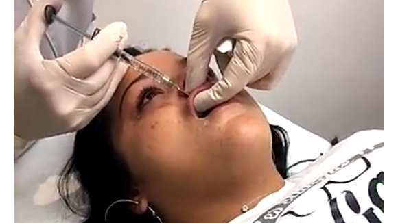 Sarah Fraisou se fait des injections dans les lèvres en direct sur Snapchat