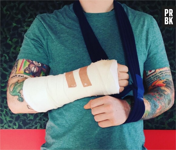 Ed Sheeran se dévoile le bras dans le plâtre sur Instagram