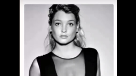 Aurélie Dotremont (Les Princes) accusée d'avoir abusé de la chirurgie esthétique, elle s'emporte