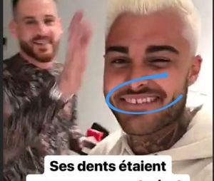 Thibault Garcia (Les Marseillais Australia) devient blond et change ses dents : le chéri de Jessica Thivenin est méconnaissable !