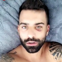 Vincent Queijo (Les Anges 10) agressé par plusieurs personnes : il dévoile sa blessure sur Snap 🤕