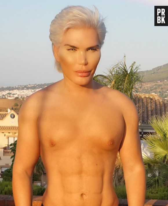 Rodrigo Alves : le "Ken humain" se fait faire un lifting aux fesses