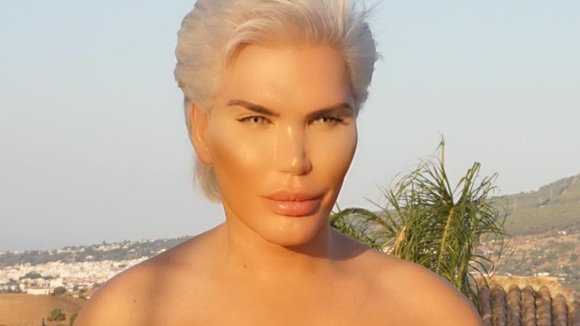 Rodrigo Alves : le "Ken humain" se fait faire un lifting aux fesses