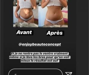 Emma CakeCup assume son corps dans sa story sur Instagram