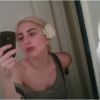 Lady Gaga est la dernière star en date à se montrer sans maquillage. Ça change !