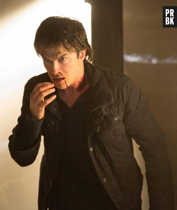 Damon amoché dans l'épisode 14 de la saison 4 de Vampire Diaries