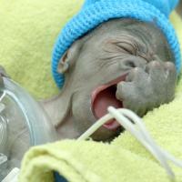 [CUTE] Jeune miraculé : un bébé gorille est né par césarienne à San Diego