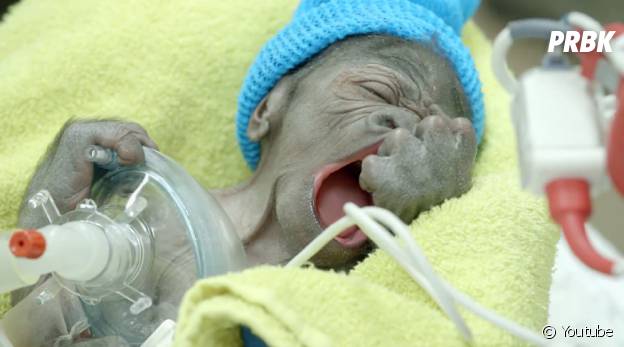 Cute Jeune Miracule Un Bebe Gorille Est Ne Par Cesarienne A San Diego Purebreak