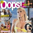  Amélie Neten en Une du magazine Oops pour son opération aux oreilles 