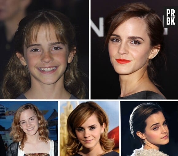 Emma Watson a 25 ans : l'avant/après impressionnant
