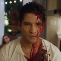 Teen Wolf : Scott et Lydia morts... pour la promo sanglante de Scream