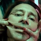 Bob Sinclar déformé par la chirurgie esthétique ?