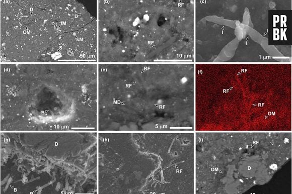 Nous avons trouvé de la vie dans l'échantillon de l'astéroïde Ryugu. Malheureusement, il s'agit d'une vie 100 % terrestre.